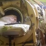 Martha Lillard, last U.S. patient reliant on iron lung, passes away at 78 in Oklahoma