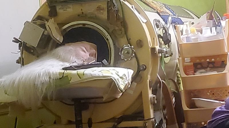 Martha Lillard, last U.S. patient reliant on iron lung, passes away at 78 in Oklahoma