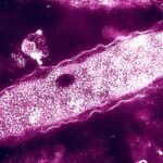 One death reported amid growing Legionnaires’ disease outbreak in New York City