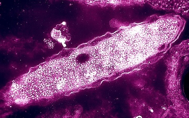 One death reported amid growing Legionnaires’ disease outbreak in New York City
