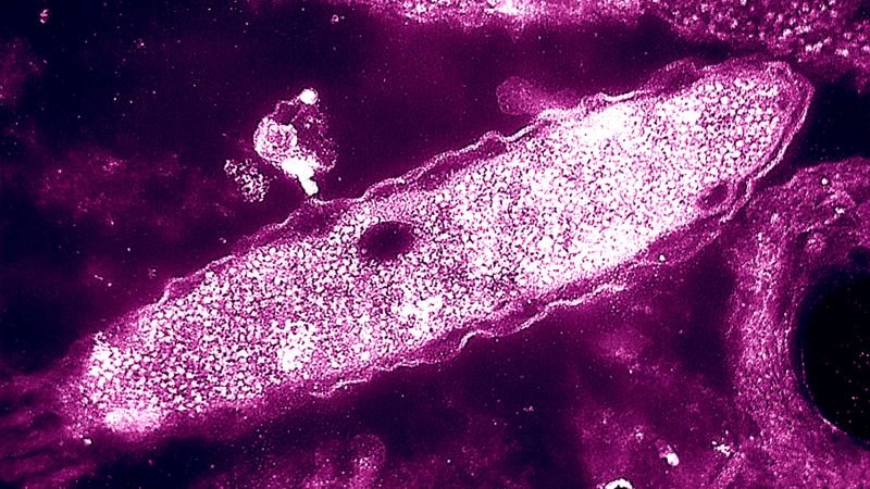 One death reported amid growing Legionnaires’ disease outbreak in New York City