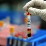 Simple cholesterol tests can help prevent heart attacks, experts advise