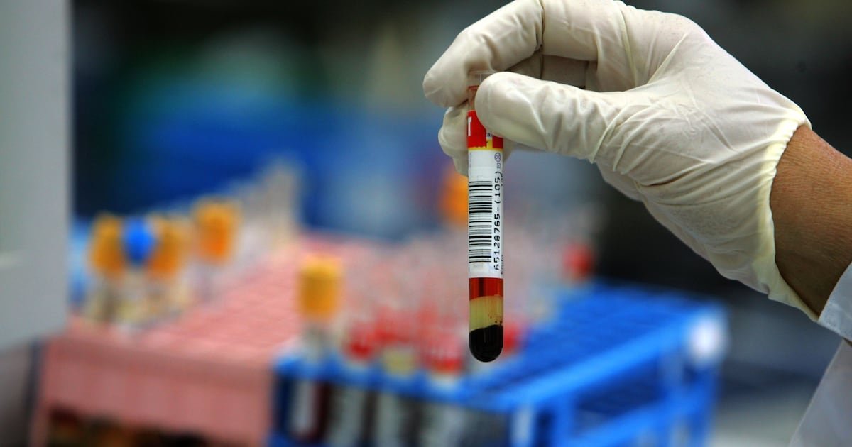 Simple cholesterol tests can help prevent heart attacks, experts advise