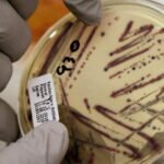 Alfalfa sprout outbreak linked to food poisoning cases across 15 U.S. states