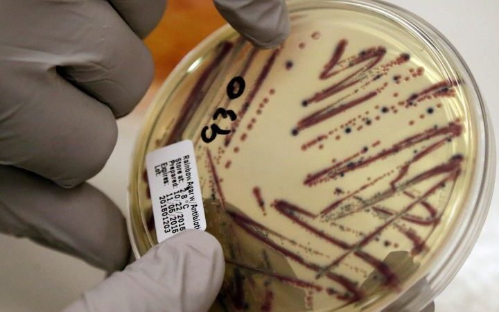 Alfalfa sprout outbreak linked to food poisoning cases across 15 U.S. states