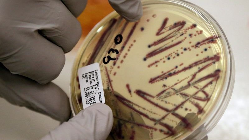 Alfalfa sprout outbreak linked to food poisoning cases across 15 U.S. states
