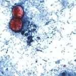 First deaths confirmed in Michigan's cyclosporiasis outbreak