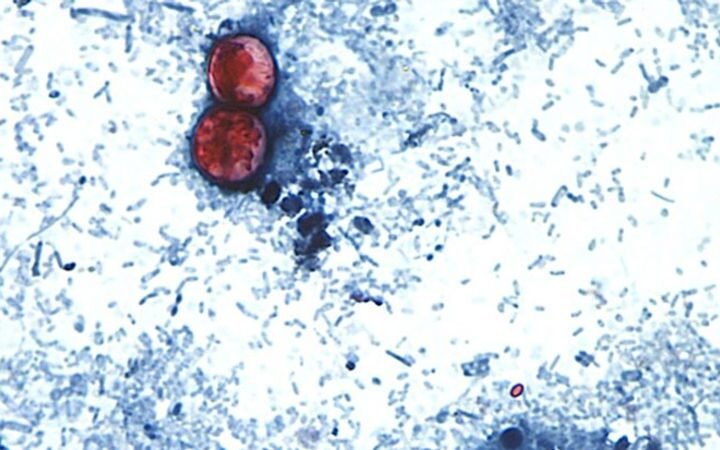 First deaths confirmed in Michigan's cyclosporiasis outbreak