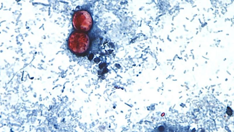 First deaths confirmed in Michigan's cyclosporiasis outbreak