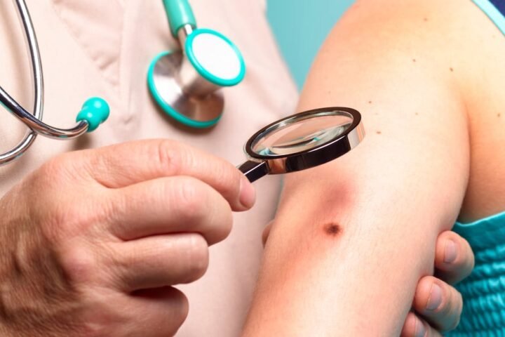 Moderna and Merck's personalised vaccine shows promise against melanoma in clinical trial