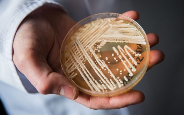 Rising Candida auris cases highlight urgent public health threat in healthcare facilities