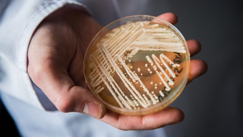Rising Candida auris cases highlight urgent public health threat in healthcare facilities