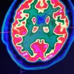 Scientists explore new brain drug Oveporexton as potential solution for fatigue and concentration issues