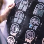 Study highlights key lifestyle changes to reduce dementia risk in middle age
