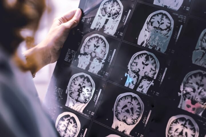Study highlights key lifestyle changes to reduce dementia risk in middle age