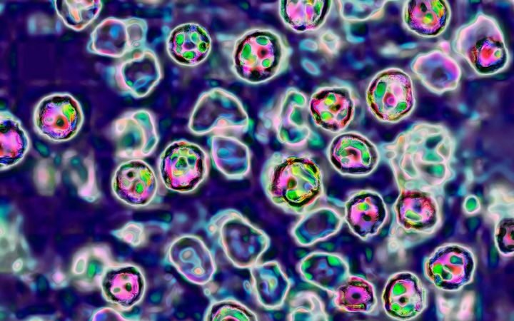 Two fatalities reported from measles outbreak in Pennsylvania, amid rising cases