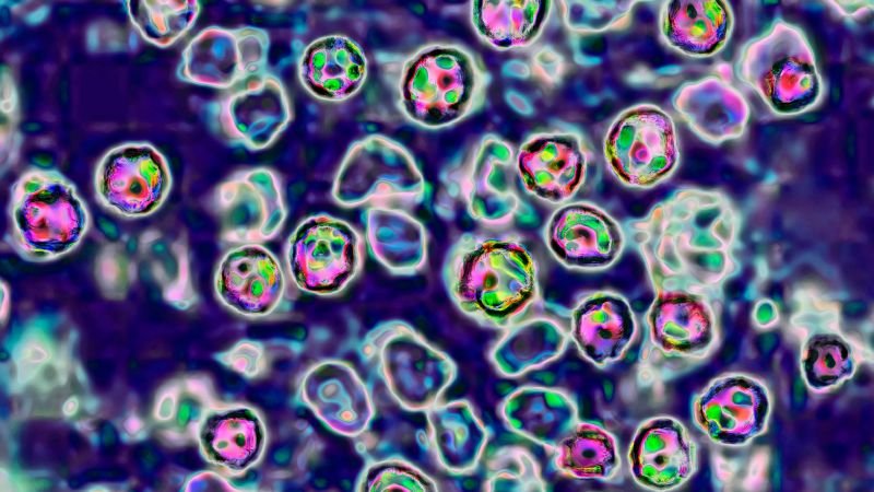 Two fatalities reported from measles outbreak in Pennsylvania, amid rising cases