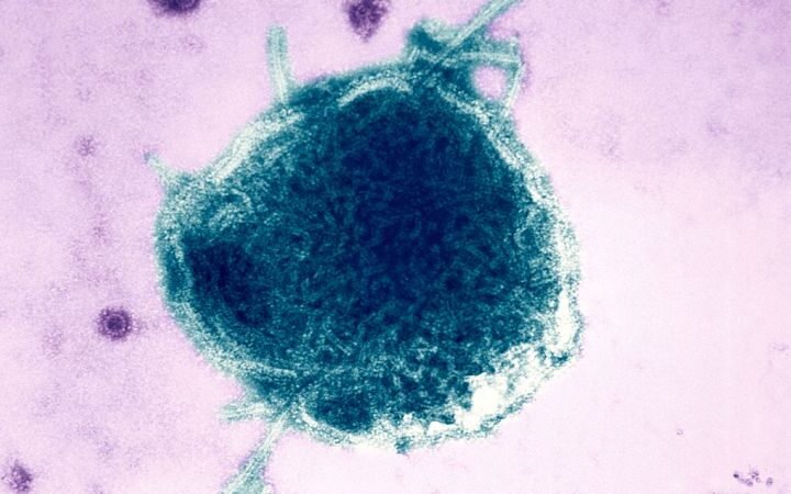 War of words erupts after two measles-related deaths reported in Pennsylvania