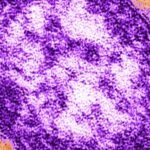 Adult woman dies amid worsening measles outbreak in Pennsylvania