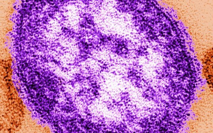 Adult woman dies amid worsening measles outbreak in Pennsylvania