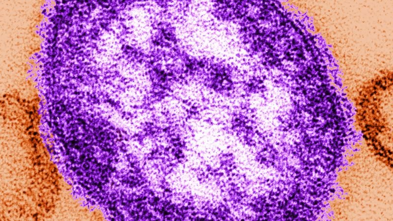 Adult woman dies amid worsening measles outbreak in Pennsylvania