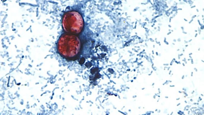 Federal officials prepare to announce end of largest US cyclosporiasis outbreak linked to lettuce