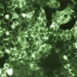 Fourth measles-related death in Pennsylvania marks unprecedented toll in the US