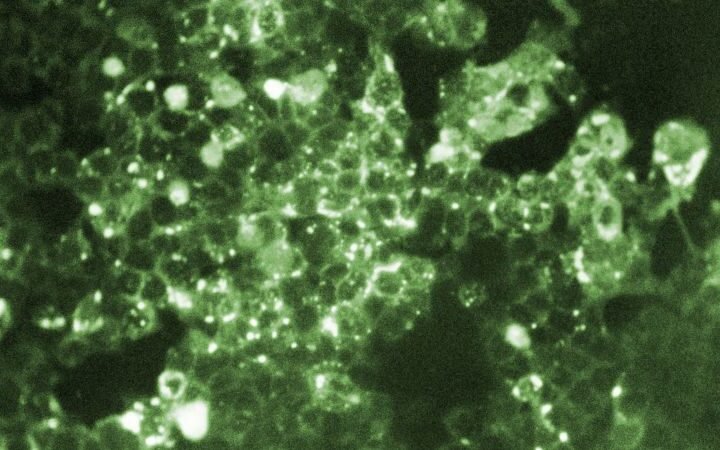 Fourth measles-related death in Pennsylvania marks unprecedented toll in the US
