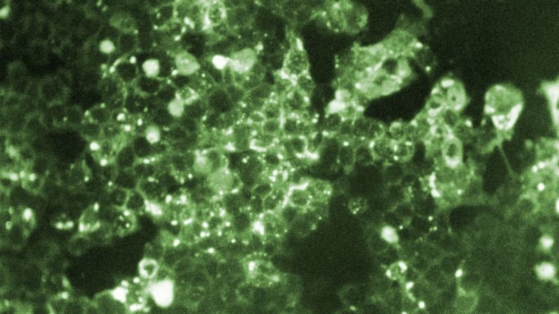 Fourth measles-related death in Pennsylvania marks unprecedented toll in the US