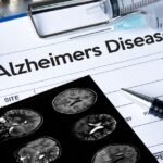 Major advances in dementia research spark optimism but challenges remain for treatment rollout