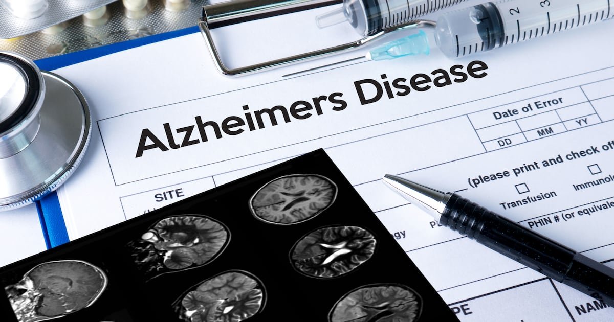 Major advances in dementia research spark optimism but challenges remain for treatment rollout