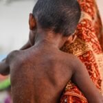 Measles outbreak in Bangladesh claims nearly 1,000 lives amid vaccination setbacks