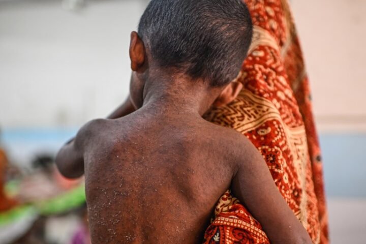 Measles outbreak in Bangladesh claims nearly 1,000 lives amid vaccination setbacks