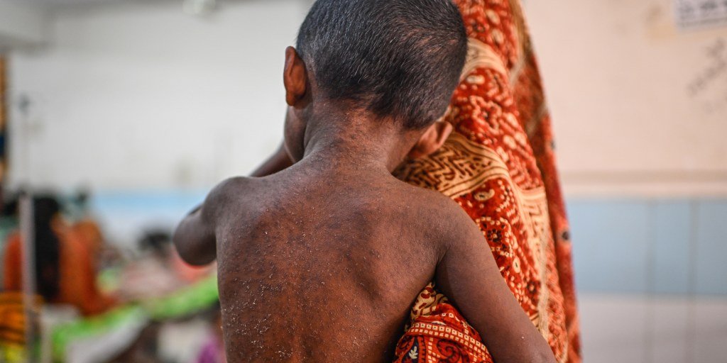 Measles outbreak in Bangladesh claims nearly 1,000 lives amid vaccination setbacks
