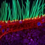 Microscopic video of abnormal cell movement in child with rare disorder wins Nikon prize