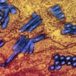 Nearly 300 people evaluated for rabies after exposure to infected goats in North Carolina