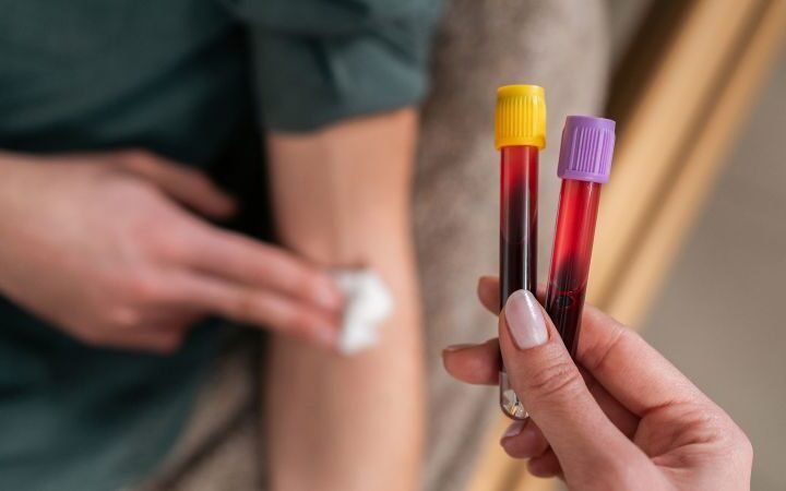 Routine blood tests may reveal early colorectal cancer risks in adults under 45