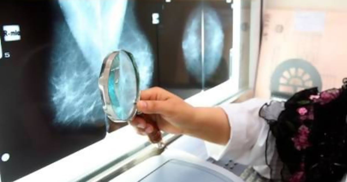 Type 2 diabetes linked to increased cancer risk, particularly among women, study finds