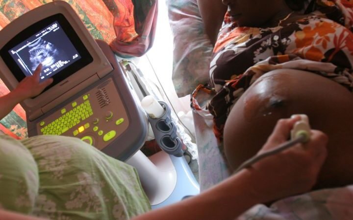 US cuts to global health funding disrupt HIV services for mothers and children in Tanzania