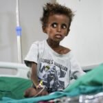 Yemen's civil war escalates, straining hospitals and leaving many in dire conditions