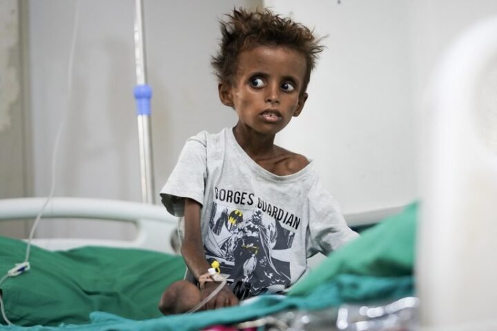 Yemen's civil war escalates, straining hospitals and leaving many in dire conditions