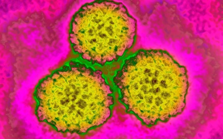 1 in 8 global cancer cases linked to treatable infections, new study reveals