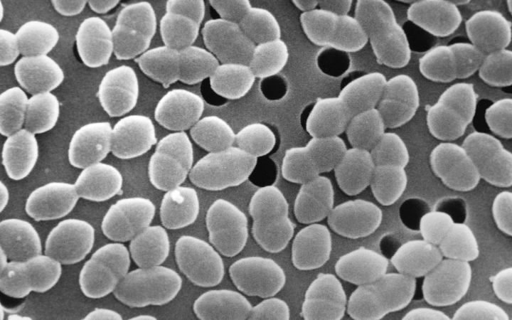 Consumption of sugar alongside antibiotics linked to harm in gut bacteria
