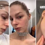 Experts caution against the risks of the 'glass skin' beauty trend on social media