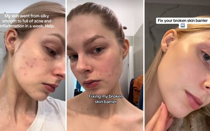 Experts caution against the risks of the 'glass skin' beauty trend on social media
