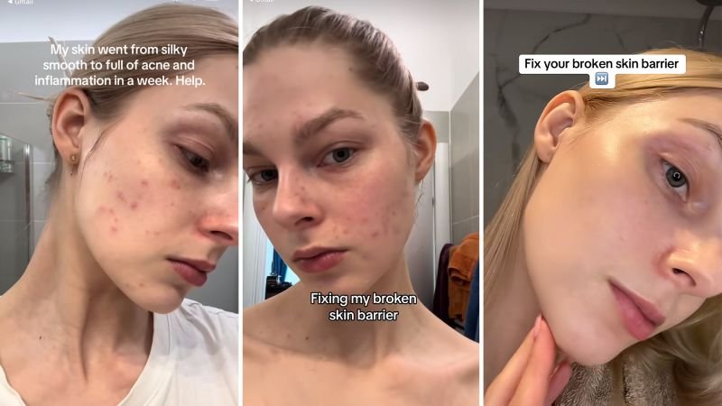 Experts caution against the risks of the 'glass skin' beauty trend on social media
