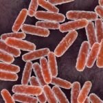 Lab worker's death prompts medical observation for 200 in Siberia amid plague concerns