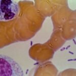 Mystery surrounds death of Russian lab worker as WHO calls for transparency on plague incident