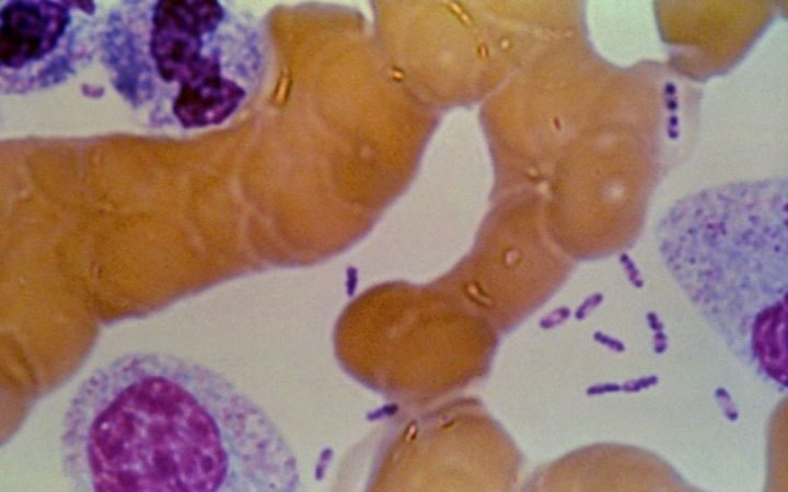Mystery surrounds death of Russian lab worker as WHO calls for transparency on plague incident