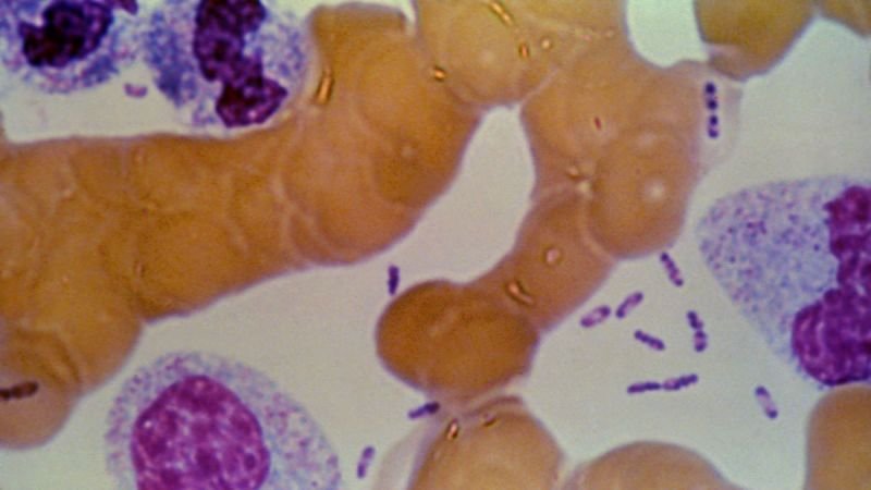 Mystery surrounds death of Russian lab worker as WHO calls for transparency on plague incident
